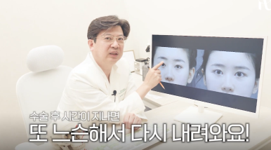 대치동성형외과 눈재수술을 통해 졸린 눈을 또렷한 눈으로 개선하는 과정 관련 이미지 6