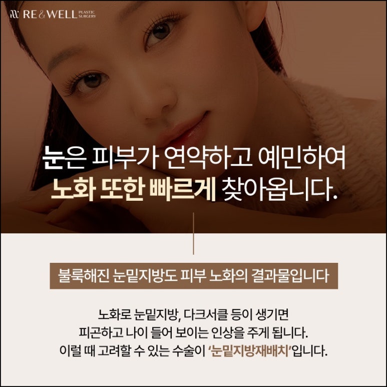 강남눈밑지성형외과 전반적인 상태 확인해야 관련 이미지 2