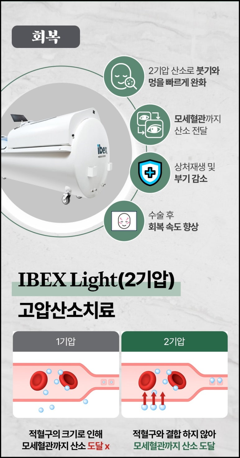 대치동성형외과 눈재수술 잘하는 곳을 찾고 계신다면 관련 이미지 7