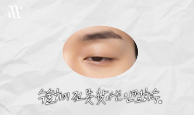 리앤웰성형외과 눈재수술을 알아보신다면 관련 이미지 7