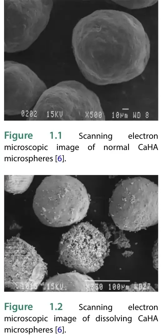 마곡 피부과, 레디어스 부작용없이 받는 법 관련 이미지 2