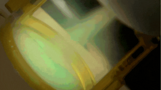 남자수염레이저 제모, 면도후트러블 해결한 리얼 경험담 관련 이미지 3