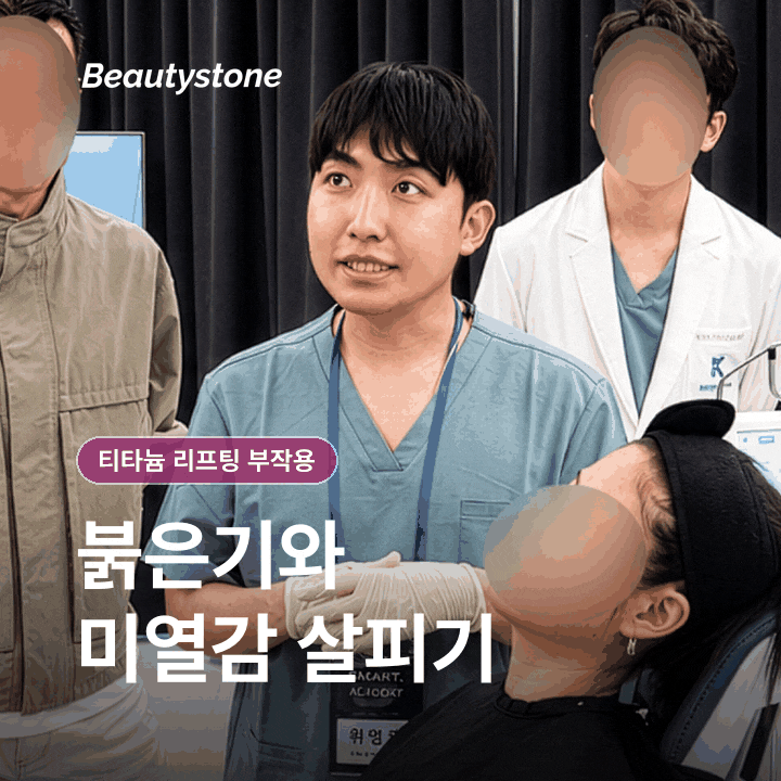 티타늄 리프팅 효과 통증·붓기, 중요한 일정 전 받아도 괜찮을까? 관련 이미지 3