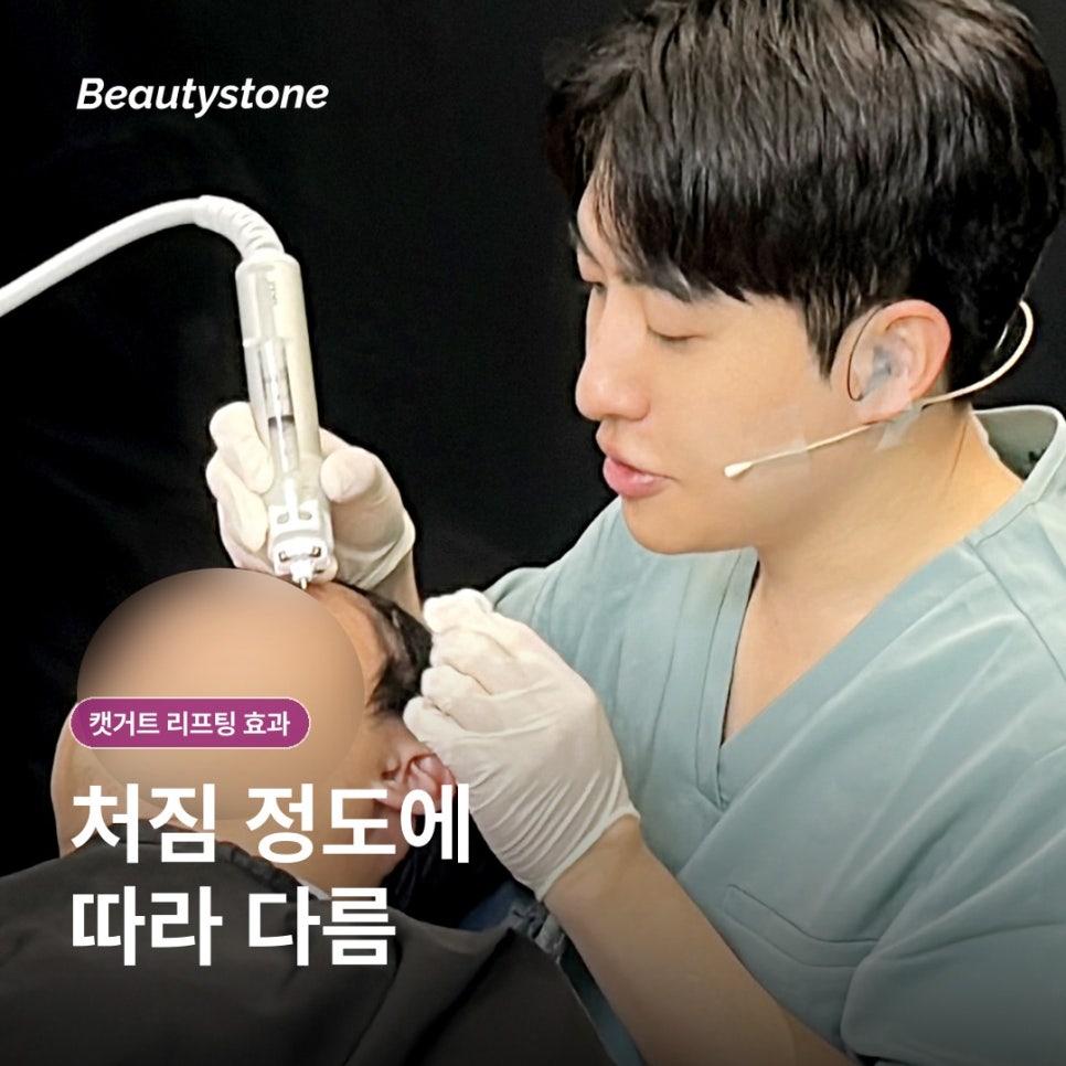 신촌 캣거트 리프팅 효과, 당김과 유지 기간은 어떻게 볼까요? 관련 이미지 6