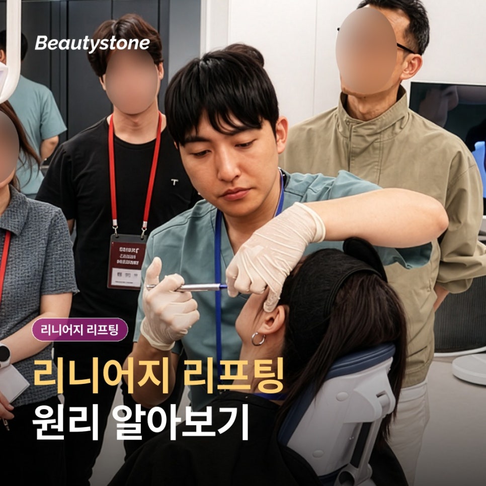 리니어지 리프팅 원리 효과부터 회복&middot;관리까지 차분히 정리 관련 이미지 1