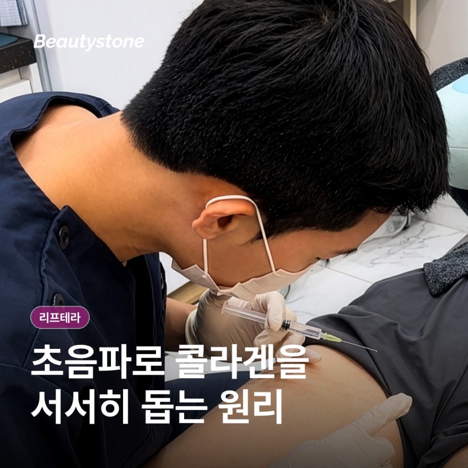 Liftera Collagen Lifting: How It Works and Realistic Expectations image 2