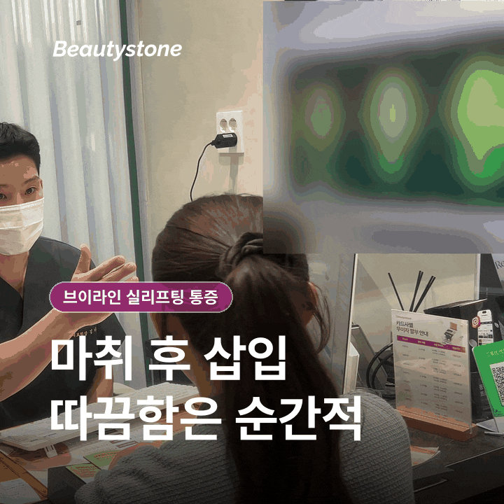 브이라인 실리프팅 통증, 어느 정도까지 정상일까 관련 이미지 4