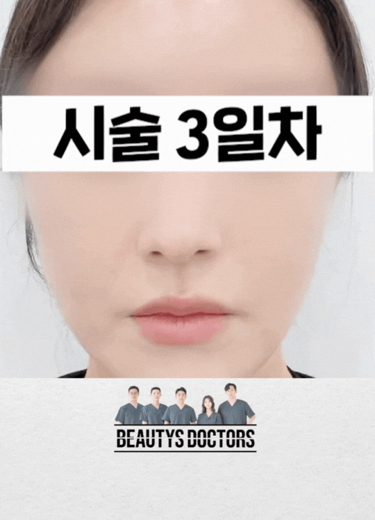 레티젠, 이 글 하나로 정리 끝 관련 이미지 2