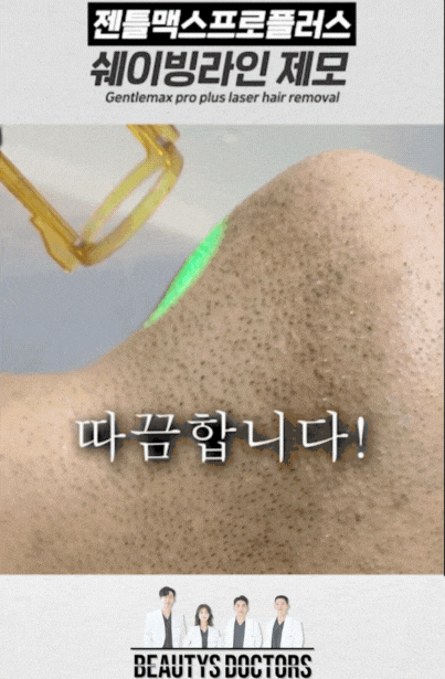 남자수염레이저 제모, 면도후트러블 해결한 리얼 경험담 관련 이미지 2