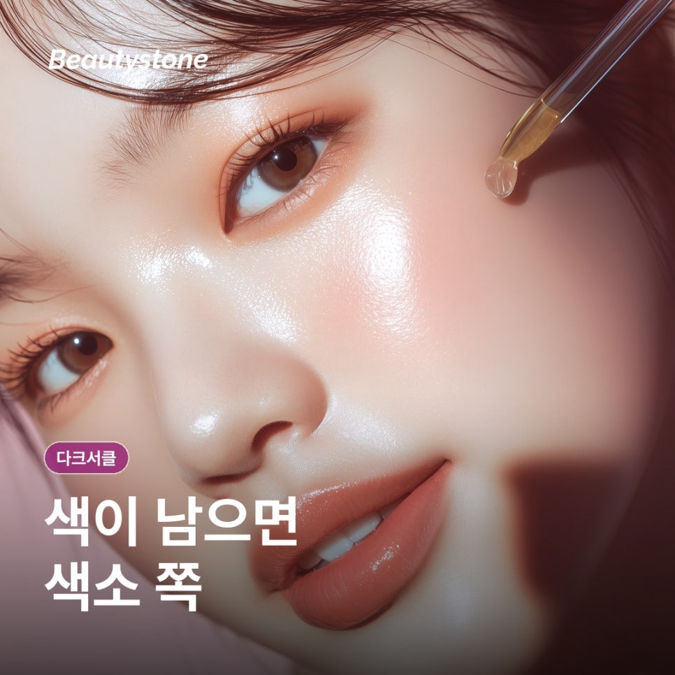 목동 다크서클 원인, 유형별로 치료가 달라지는 이유 관련 이미지 2