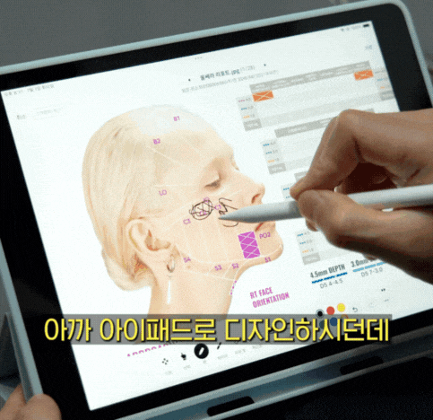 울쎄라 300샷 가격과 효과, 실제 상담에서 가장 많이 묻는 질문 관련 이미지 3