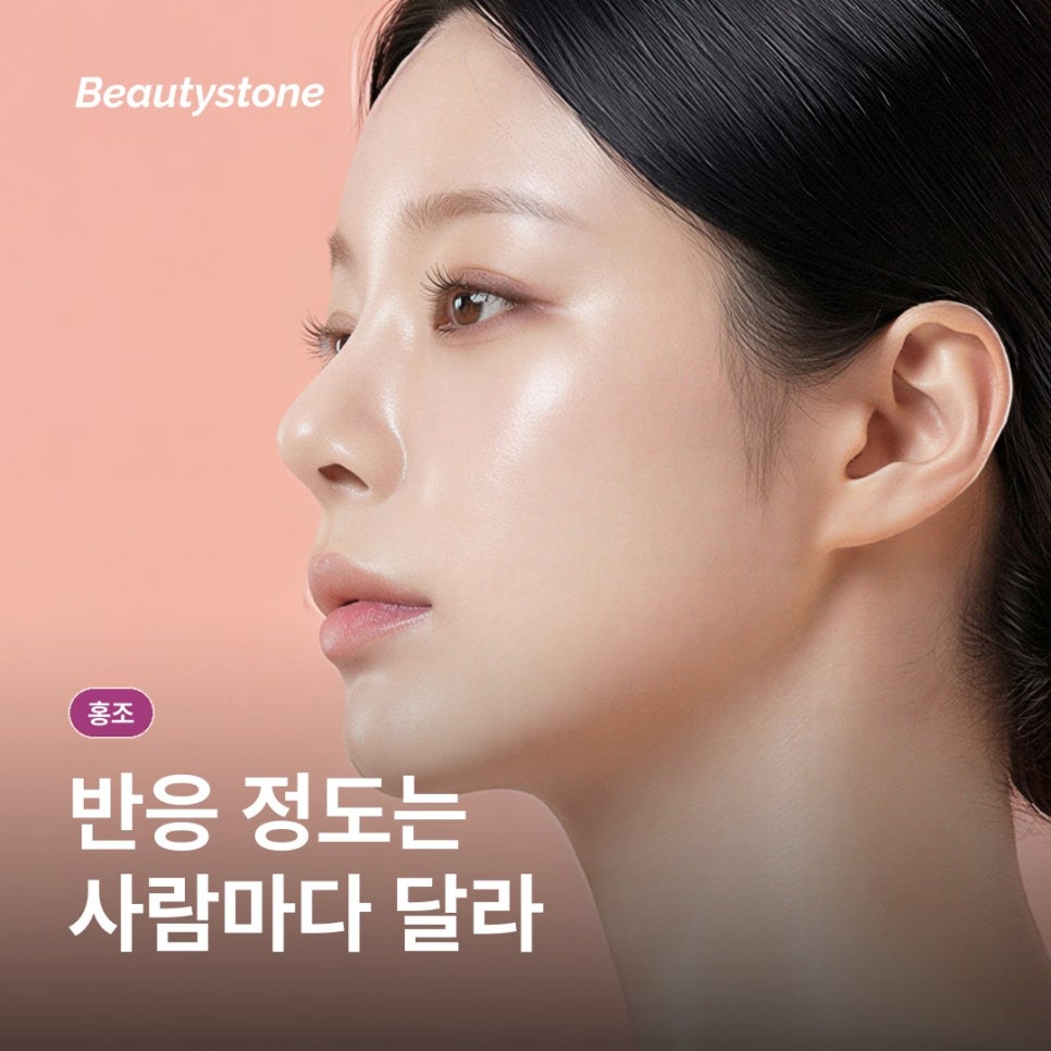 A Guide to the Causes of Persistent Facial Flushing and How to Manage It image 11