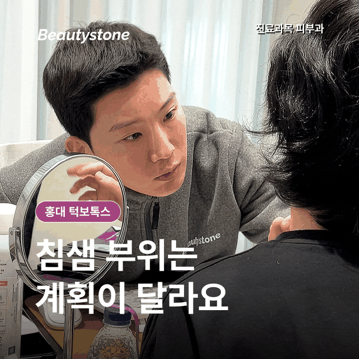 홍대 턱보톡스 전후 효과, 용량보다 씹는 습관을 먼저 보는 이유 관련 이미지 6