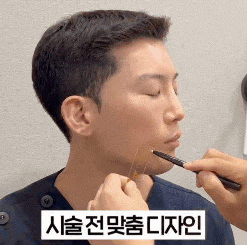 울쎄라 후 통증, 효과 부작용까지! 관련 이미지 3