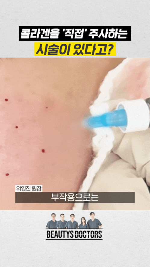 공덕 피부과 콜라겐주사, 기다리지 않고 바로 채우는 레티젠 관련 이미지 5