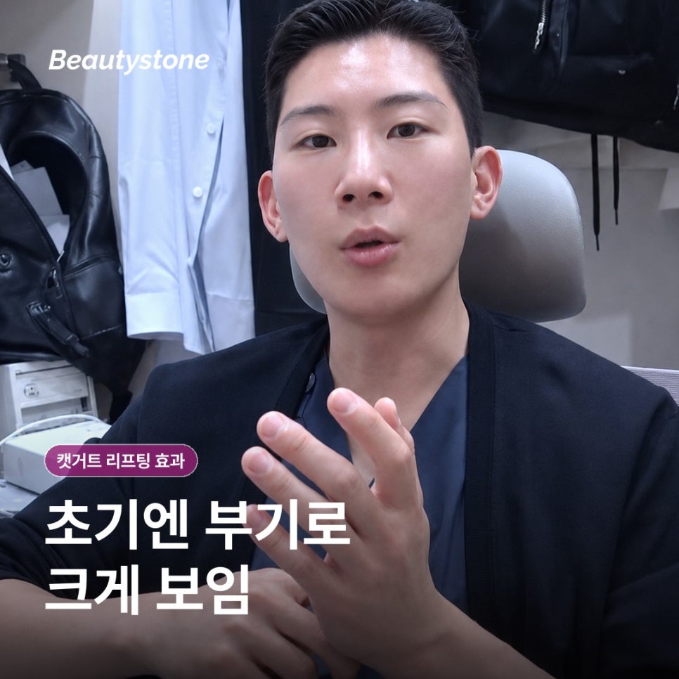 신촌 캣거트 리프팅 효과, 당김과 유지 기간은 어떻게 볼까요? 관련 이미지 7