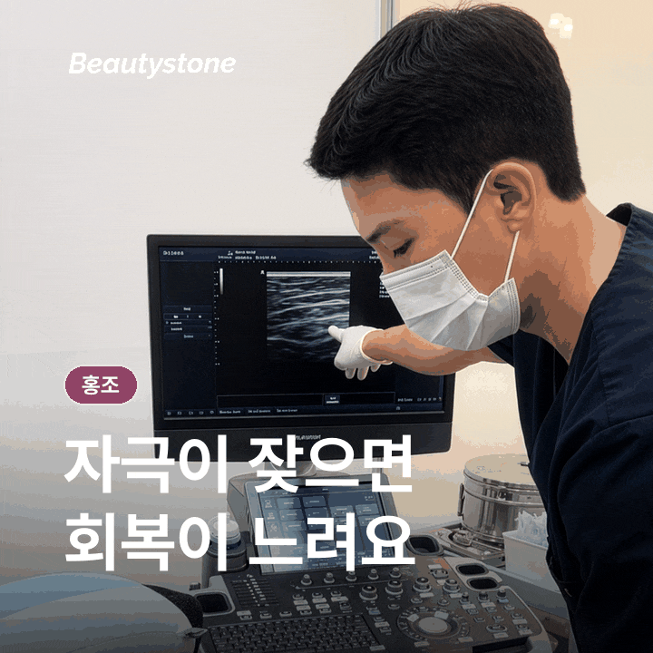 A Guide to the Causes of Persistent Facial Flushing and How to Manage It image 6