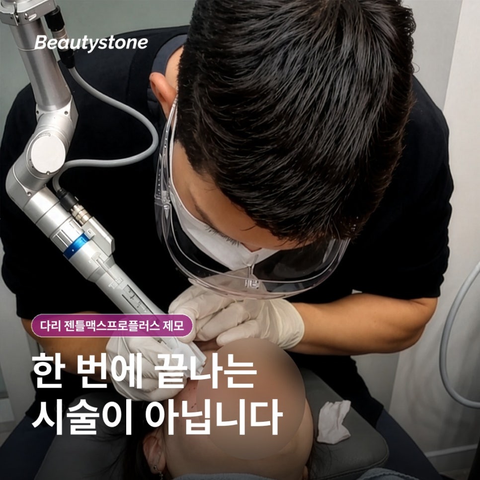 다리 젠틀맥스프로플러스 제모, 원리와 회차·통증·관리까지 관련 이미지 4