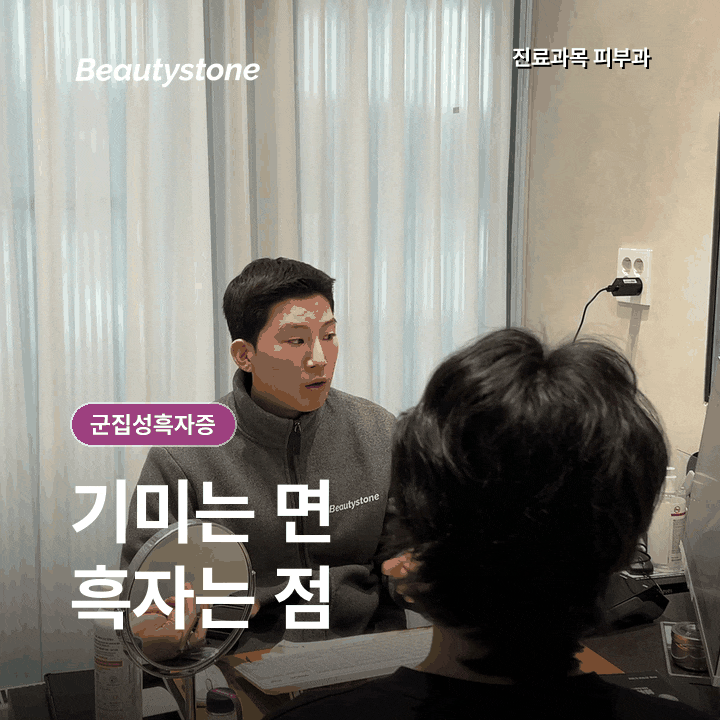군집성흑자증, 기미인 줄 알았는데 점이 모여 있다면? 관련 이미지 2