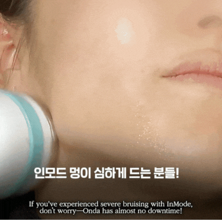 아플까 봐 망설였다면? 온다리프팅 솔직 후기 관련 이미지 4