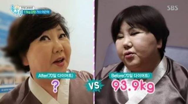 가수 이은하 쿠싱증후군, 급격한 20kg증량 쿠싱증후군 증상과 예방법 관련 이미지 2