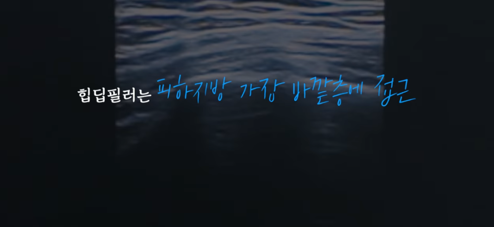 힙딥 필러, 잘하는 곳은 다릅니다 관련 이미지 5