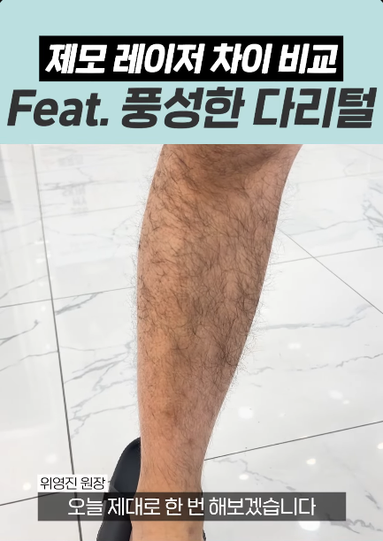 홍대입구역 피부과 남자다리털 제모, 반복 없이 줄이는 핵심 관련 이미지 2