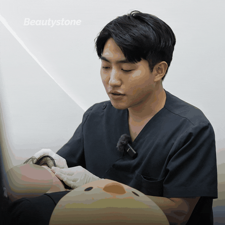 광화문 오타모반 관리, 기미와 어떻게 다르게 접근할까요? 관련 이미지 9