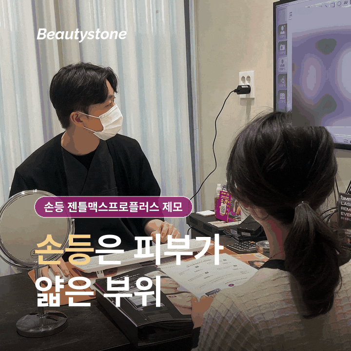 Hongdae Hand Dorsum Laser Hair Removal with GentleMax Pro Plus: What Should You Check Beforehand? image 2
