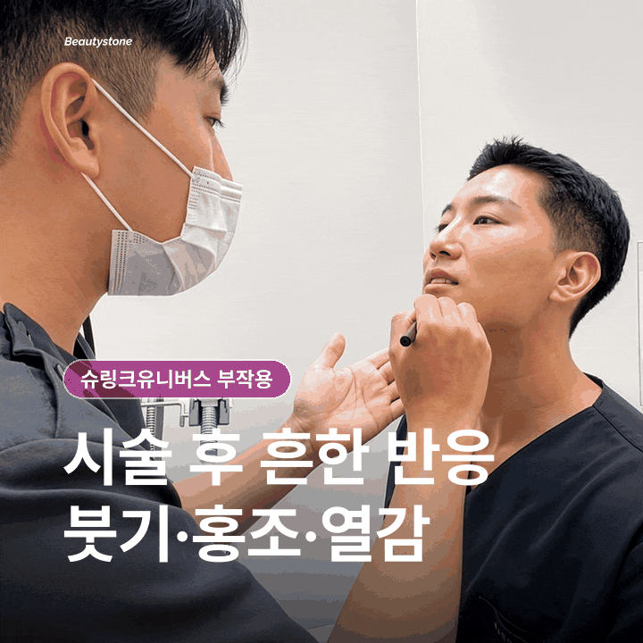 슈링크유니버스 부작용, 미리 알고 가면 덜 걱정돼요 관련 이미지 3