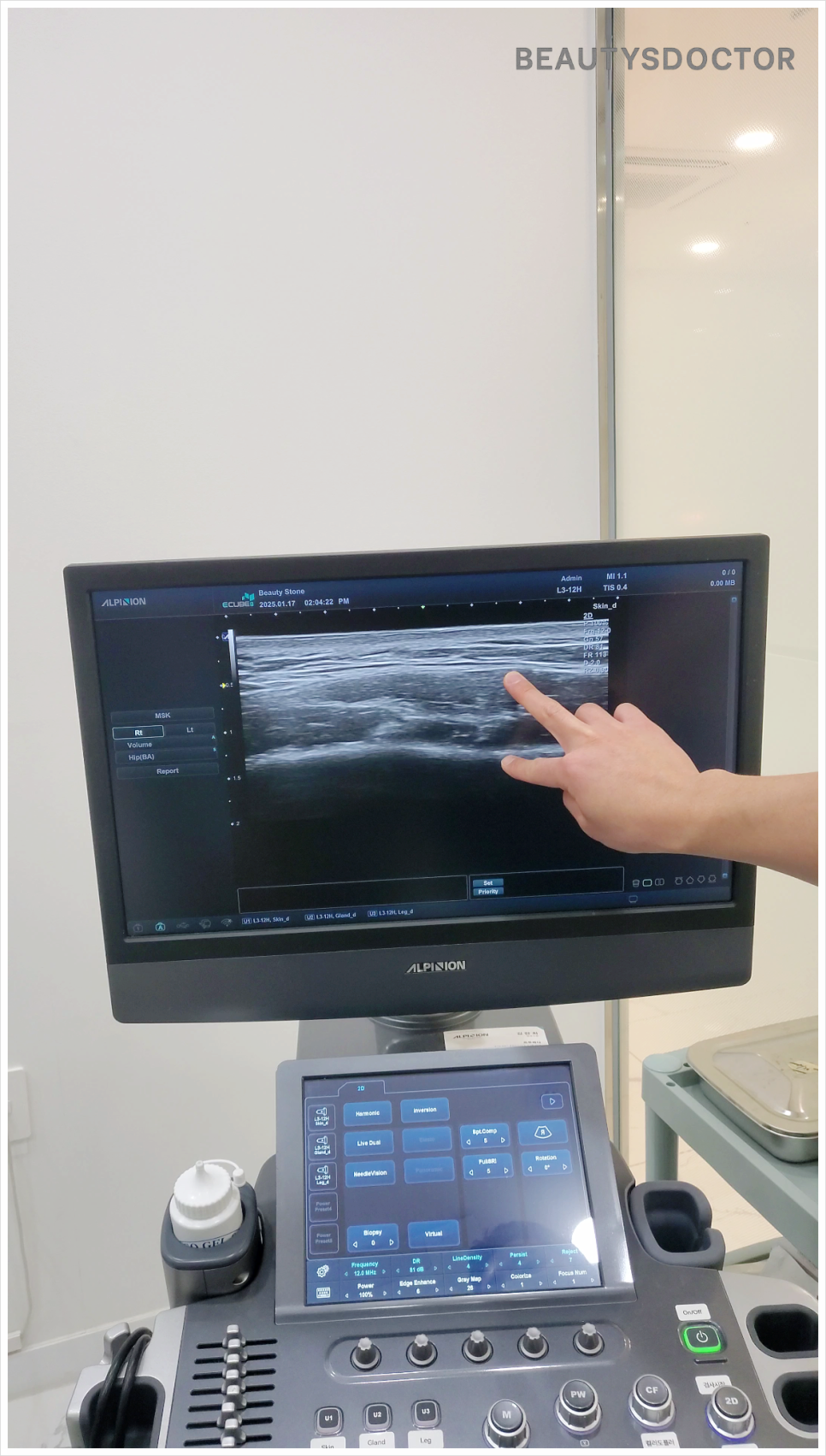 보톡스 주기 전후 비교, 언제 맞아야 가장 효과적일까 관련 이미지 5