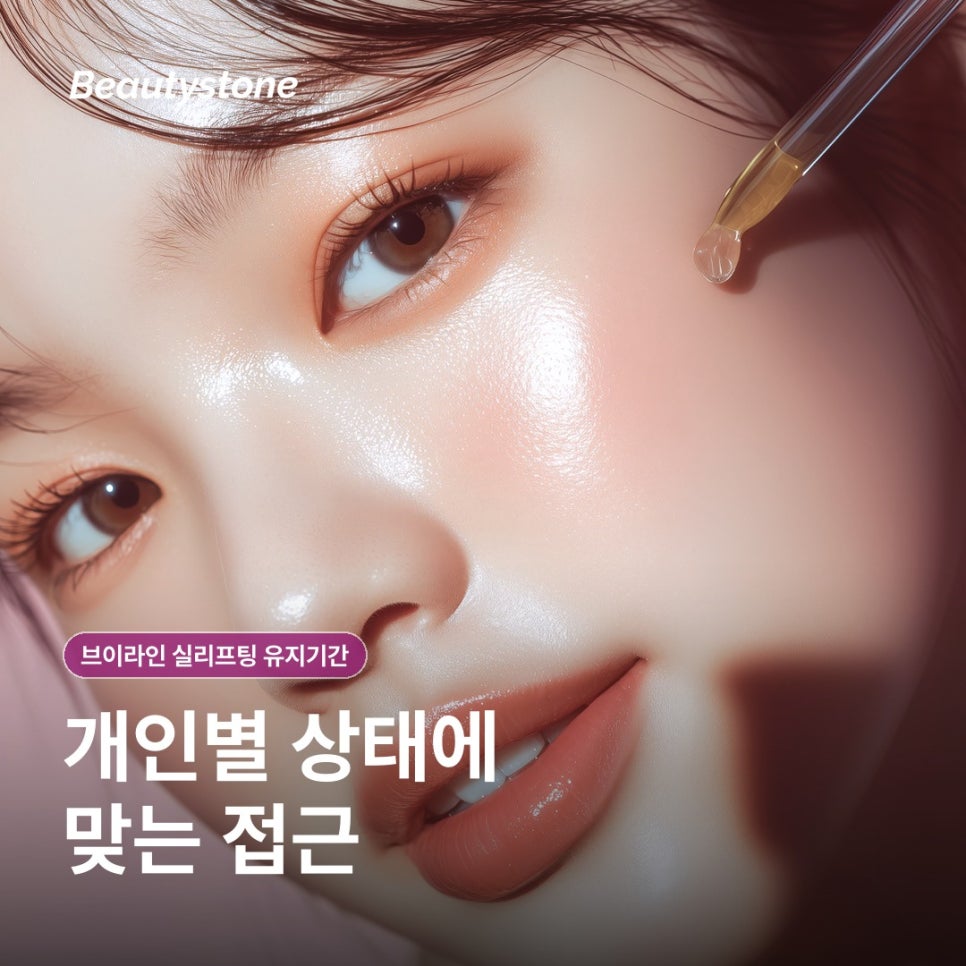 브이라인 실리프팅 유지기간, 얼마나 오래 갈까 관련 이미지 2