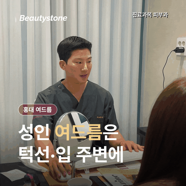 홍대 여드름, 턱선 뾰루지는 왜 반복될까? 부위별 원인부터 확인하세요 관련 이미지 2