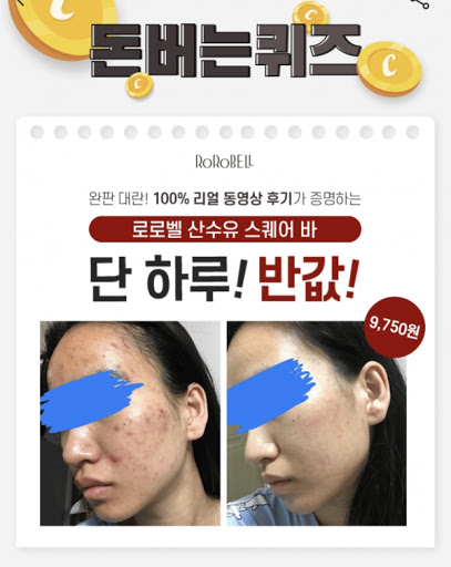 로로벨 산수유 스퀘어바, 캐시워크 문제 정답 공개 관련 이미지 1
