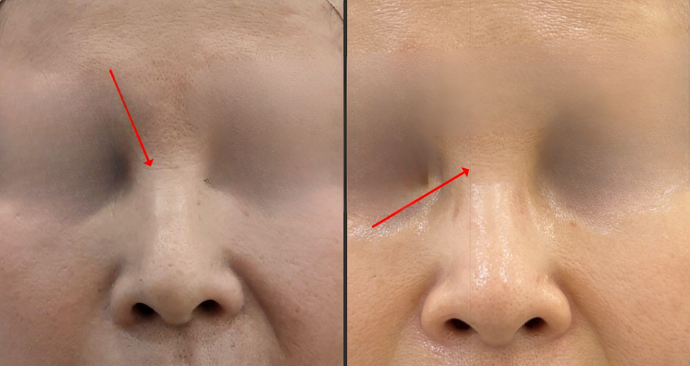 쥬베룩 볼륨, 결과가 다른 이유는 명확합니다 관련 이미지 2