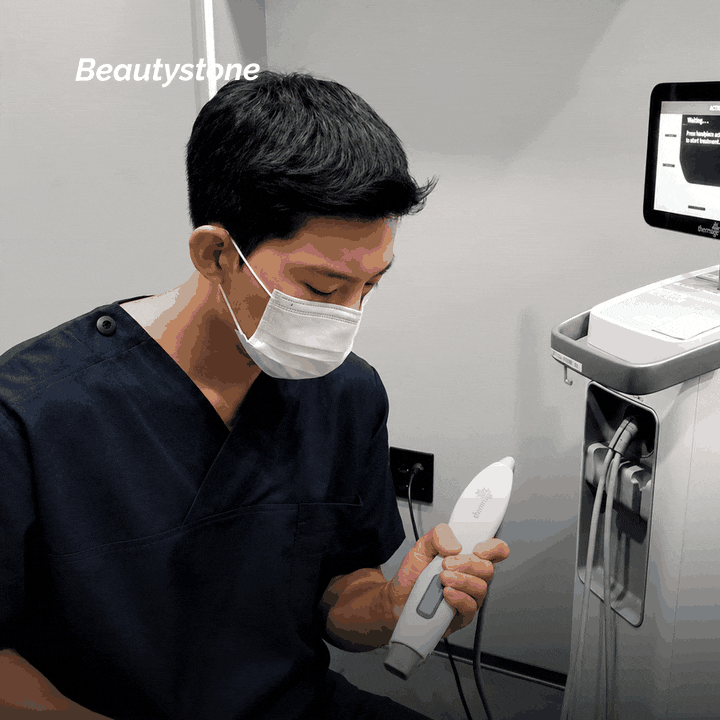 UV Care After Laser Treatment: What to Check If You’re Concerned About Hyperpigmentation image 9