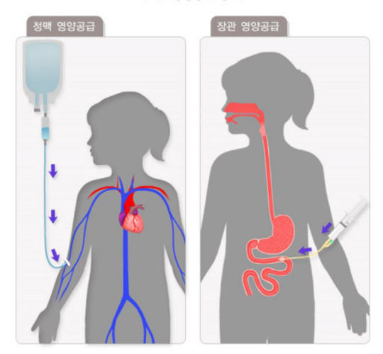 경장영양음료 과연 무엇일까? 관련 이미지 3