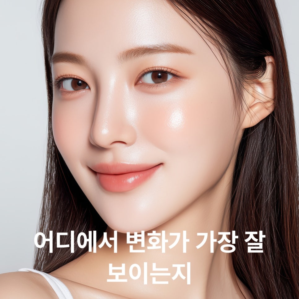 킨부스터 시술, 성분별 특징과 피부 내 작동 원리 안내 관련 이미지 3