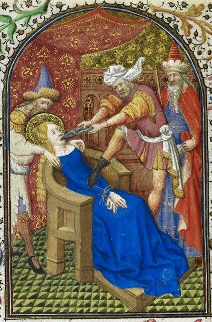 중세시대 치과 도구 관련 이미지 4