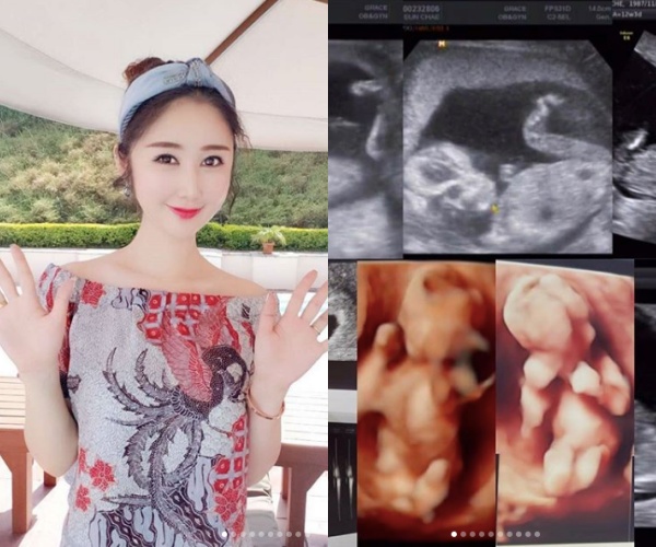 방송인 성은채, 중국인과 결혼! 2년만에 관련 이미지 5