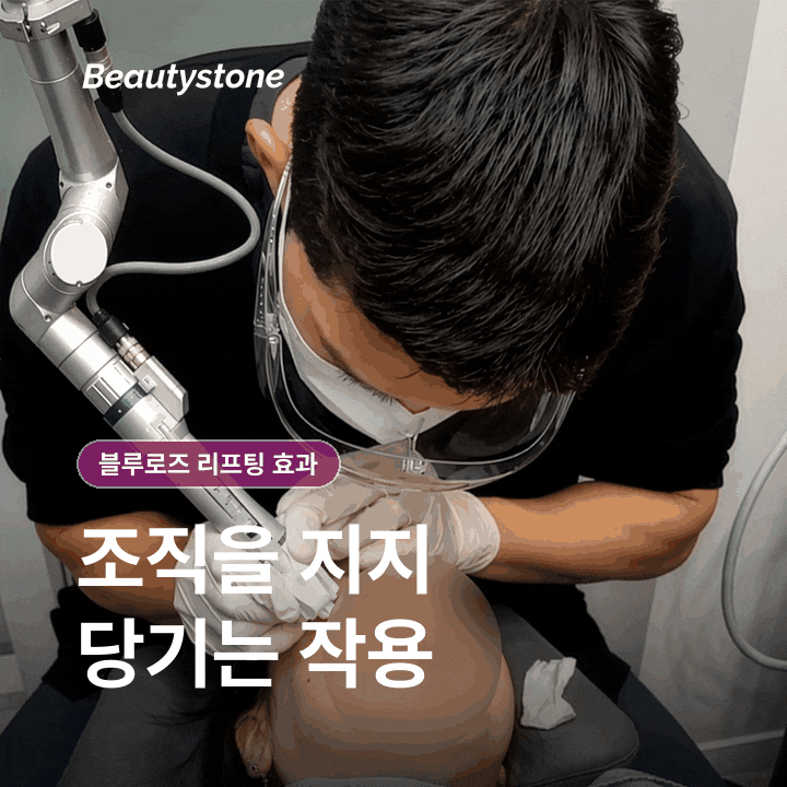 Why You Shouldn’t Judge the Effects of Seoul Blue Rose Thread Lifting by the Number of Threads Alone image 4
