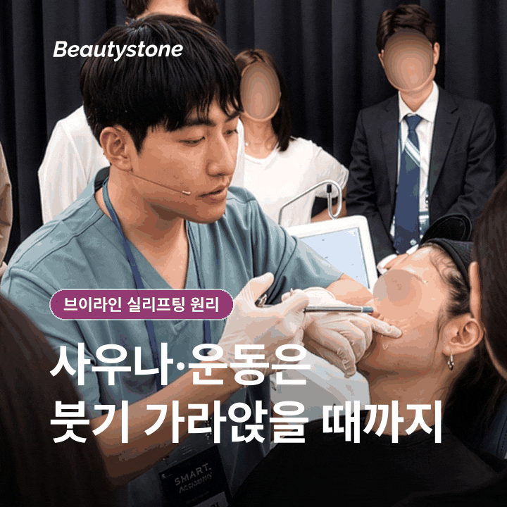 How V-Line Thread Lifting Works: What to Know Before the Procedure image 9