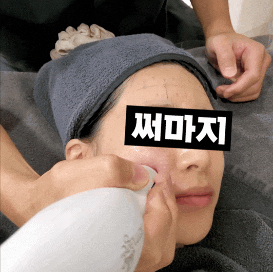 마곡 피부과 써마지 Q&A 효과&middot;샷수&middot;부작용까지 한 번에 정리 관련 이미지 3