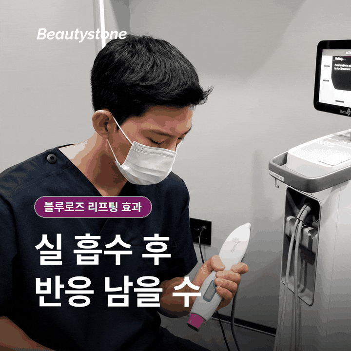 Why You Shouldn’t Judge the Effects of Seoul Blue Rose Thread Lifting by the Number of Threads Alone image 11