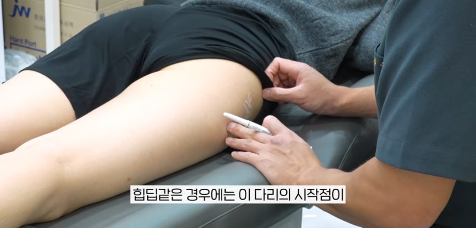 힙딥 필러, 잘하는 곳은 다릅니다 관련 이미지 4