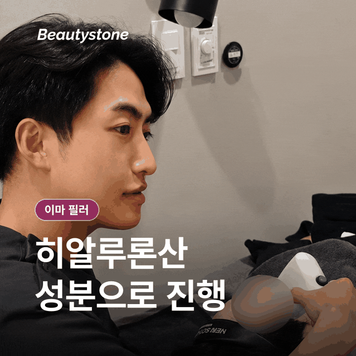 이마 필러 알아보기: 원리와 과정, 회복 관리 총정리 관련 이미지 4