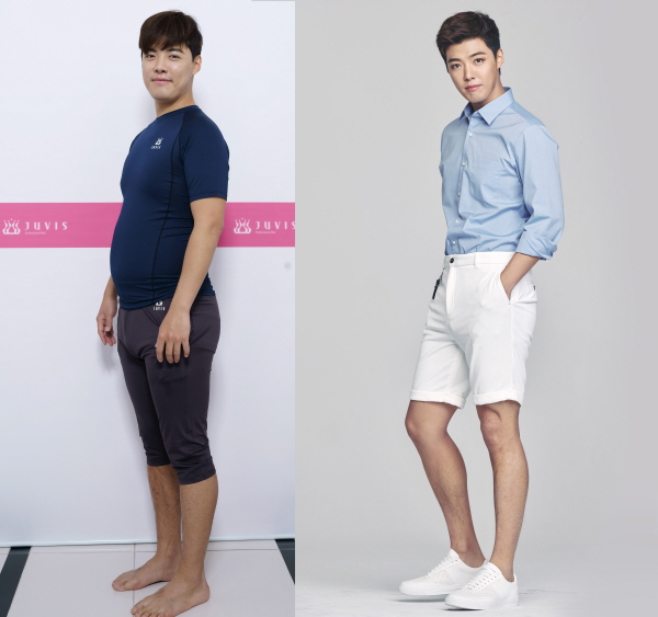 쥬비스 다이어트 화제! 연예인 후기 모음 관련 이미지 5