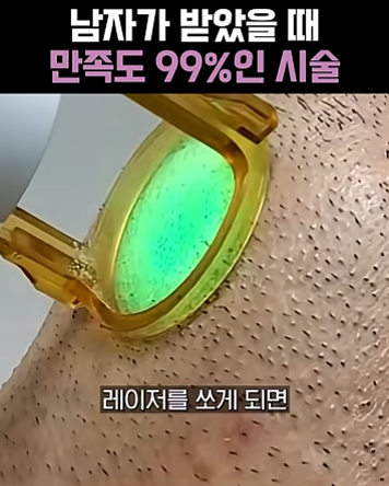 남자수염레이저제모가격 얼마일까? 수염제모 효과 제대로 보는 방법 관련 이미지 3