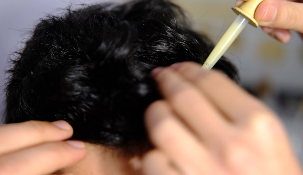 Gongdeok Dermatology, CUREJET Juvelook Pore Treatment: After How Many Sessions Will You Notice a Difference? image 6