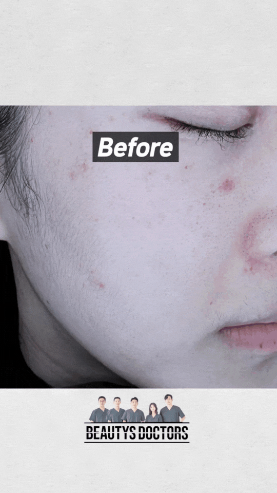 얼굴레이저제모, 원장님께 해드린 후기 관련 이미지 3